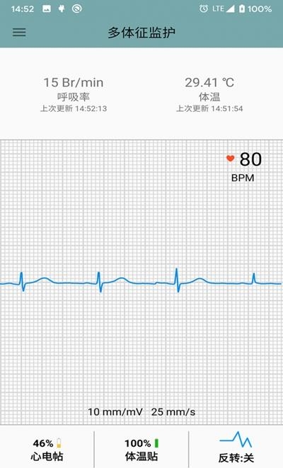 多体征监护  v1.0.1.42图3